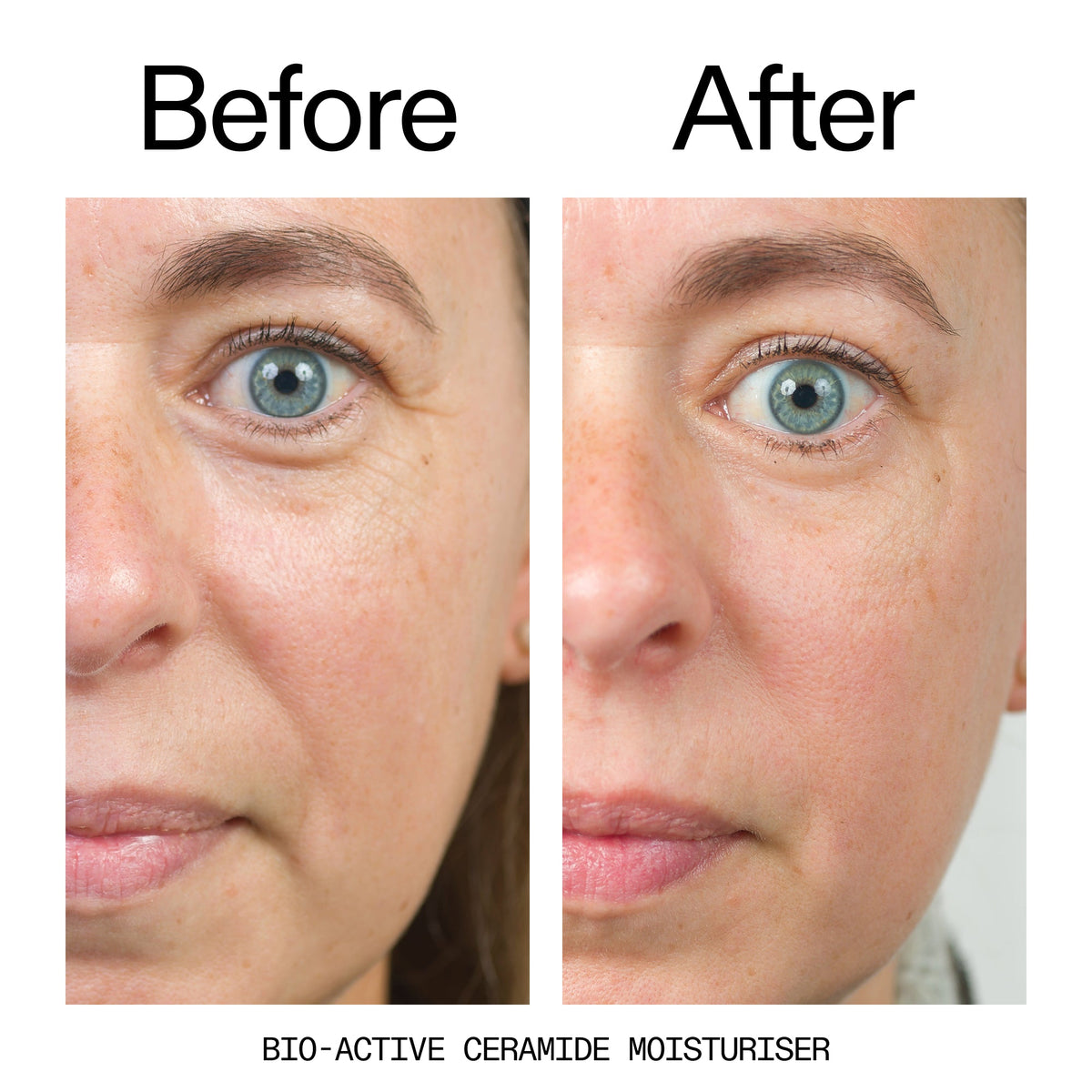 barrier-boosting-trio-g2 Bio-Active_Before_After_2000x2000_600947b4-e8c5-425a-9155-fc15bc83aa12.jpg