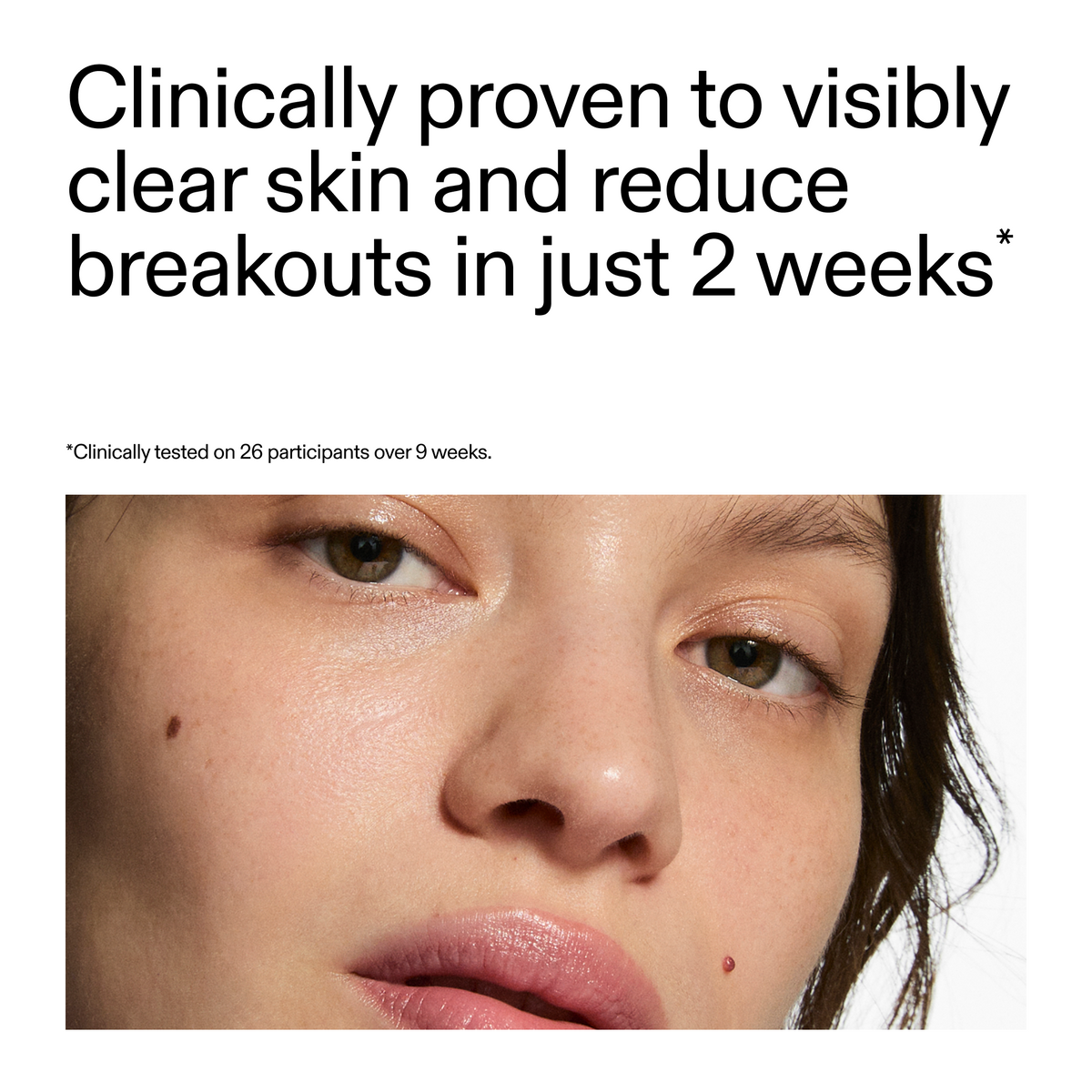 360-acne-clearing-duo-o1 360_Serum_Key_Claim.png