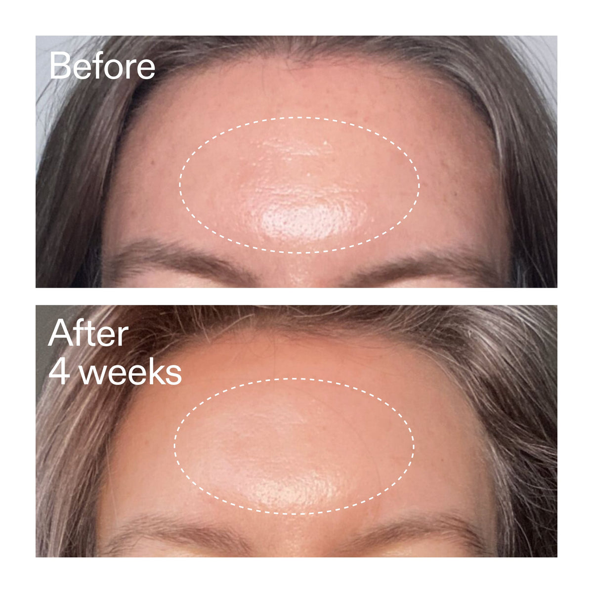 advanced-0-2-retinal-serum-u2 AdvancedRetinal_BeforeAfter1_2000x2000_1da6bb0a-29dd-41d1-95b7-8679696bbf0f.jpg
