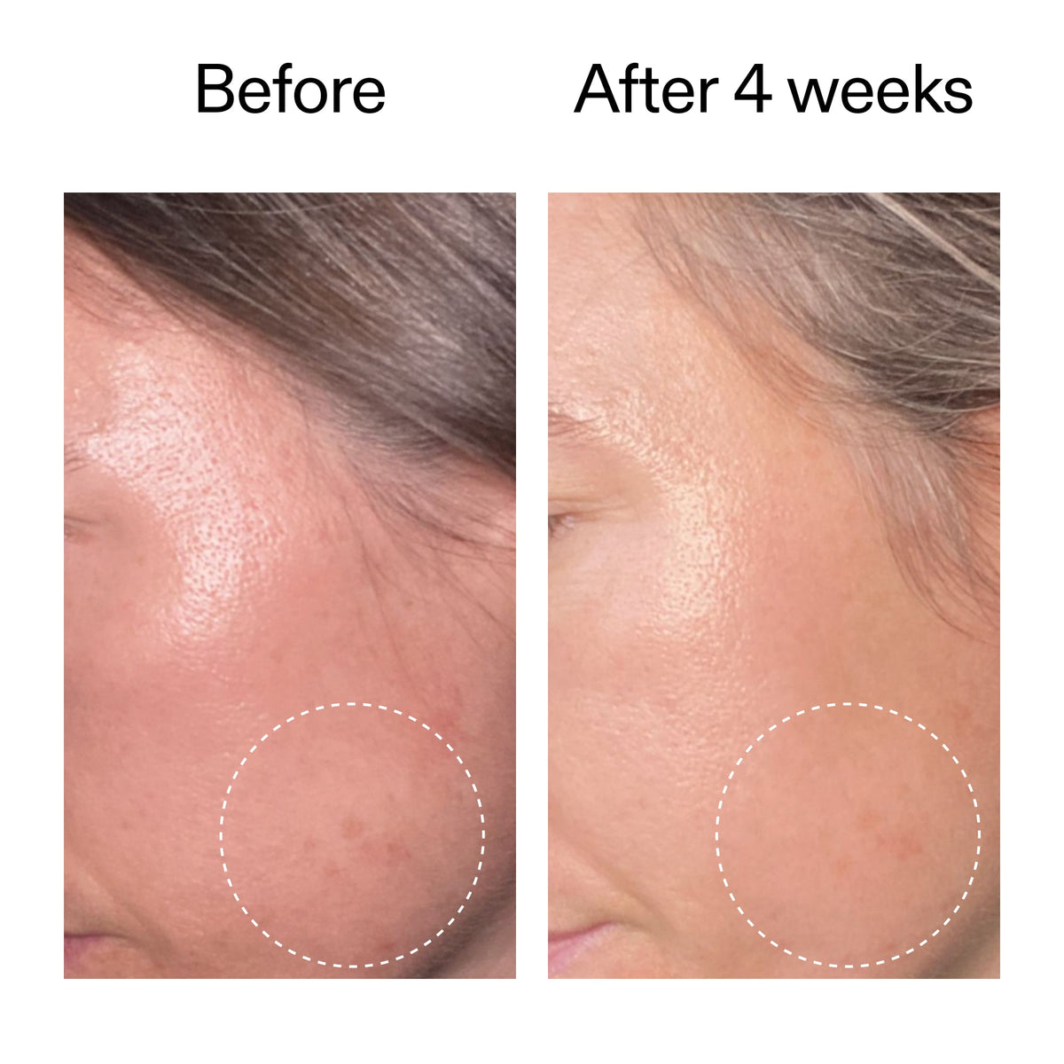 advanced-0-2-retinal-serum-u2 AdvancedRetinal_BeforeAfter2__2000x2000_62fb16bb-77ae-4d63-8500-88dbf847f4b9.jpg