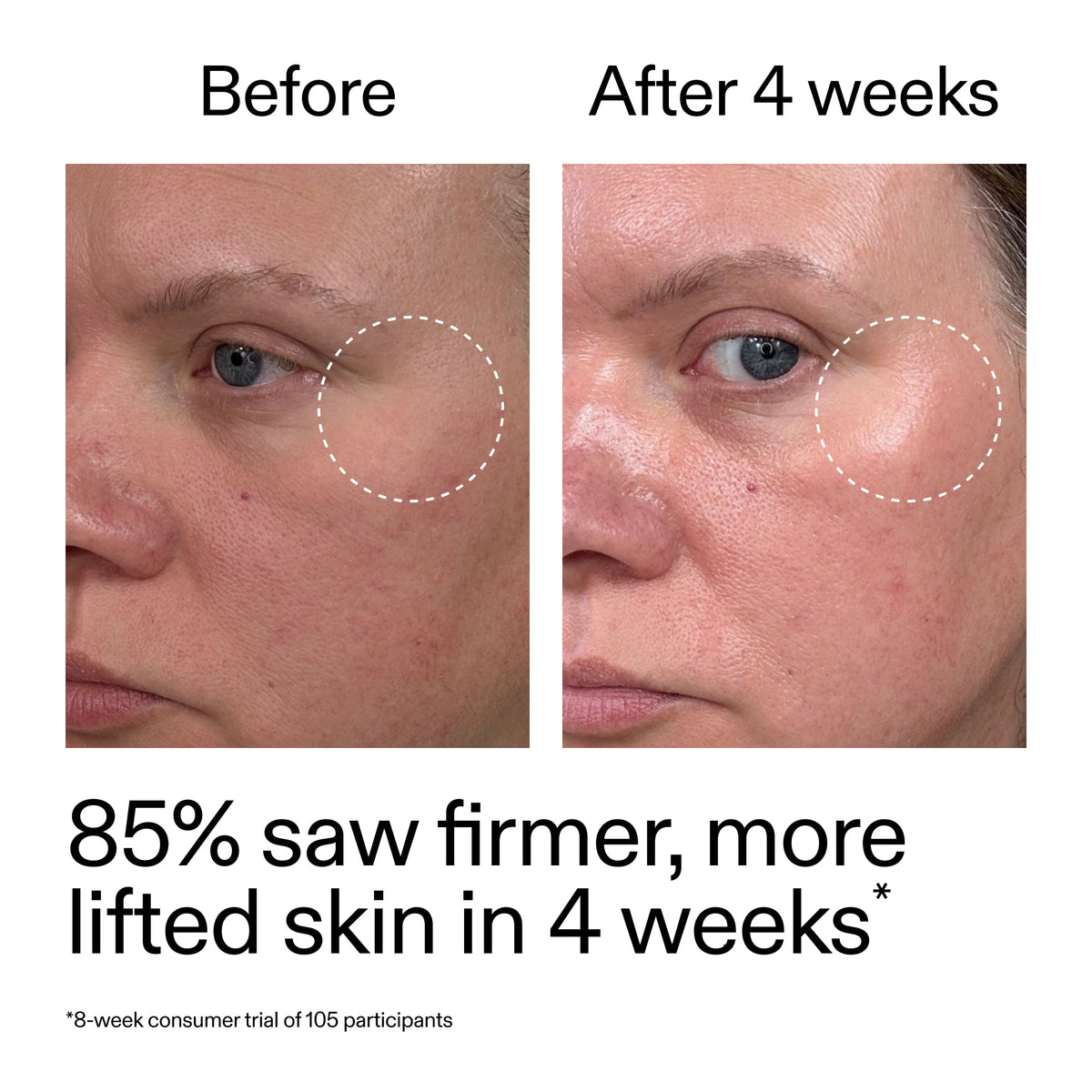 advanced-0-2-retinal-serum-u2 AdvancedRetinal_BeforeAfter_Claim1_2000x2000_bcc385c4-5e73-4f1e-aba8-64267937d0d3.jpg