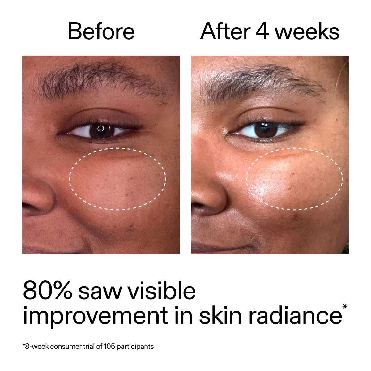 advanced-0-2-retinal-serum-duo-b7 AdvancedRetinal_BeforeAfter_Claim2_2000x2000_681b621d-8d44-4d44-9a40-89244f9b2e53.jpg