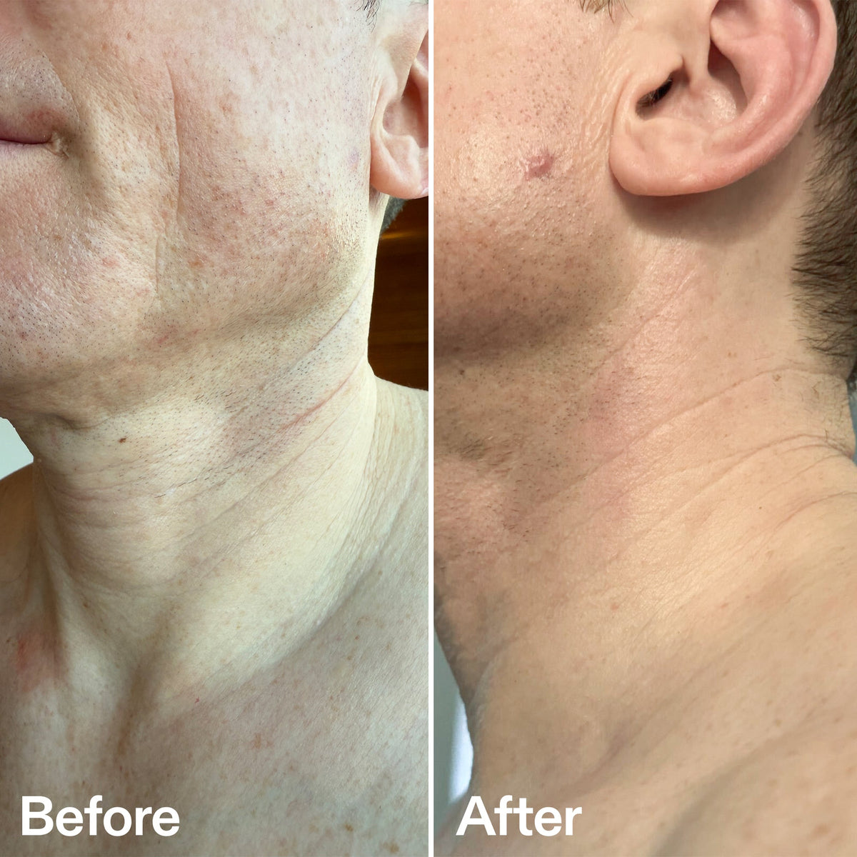 bio-active-neck-lift-stick-p3 B_A_afa2743e-b8e2-4504-92f4-e281cb6cf759.jpg