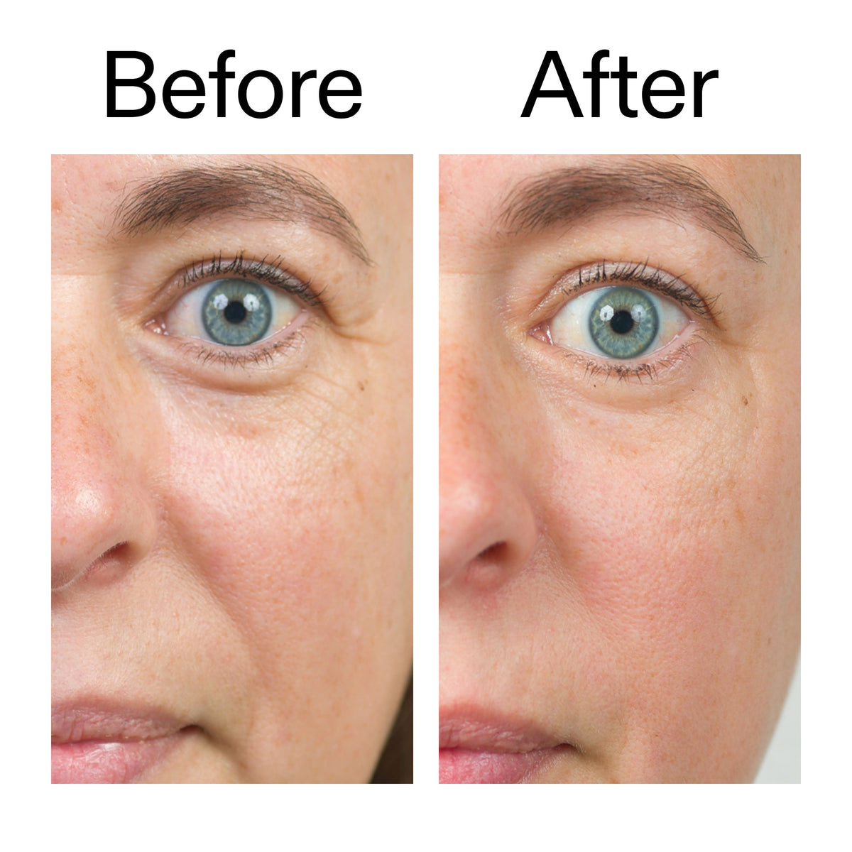 bio-active-ceramide-moisturizer-duo-c2 Bio-Active_Before_After_2000x2000_566e5a9e-135e-417a-8242-b44e5fa35463.jpg