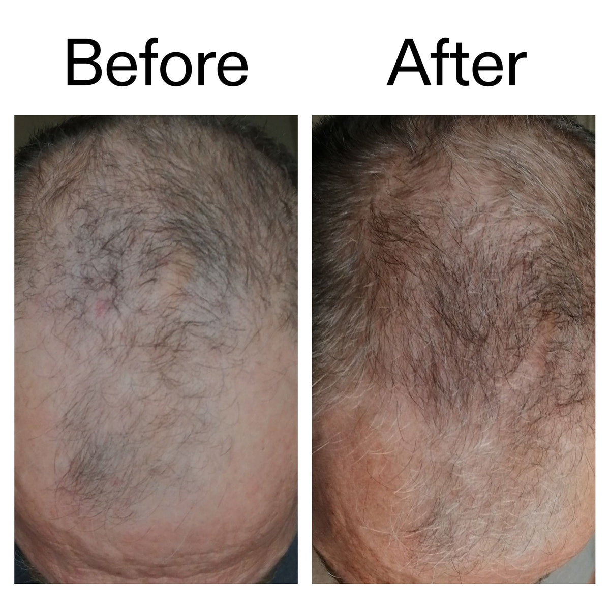 caffeine-stimulating-scalp-treatment-a6 Caffeine_Scalp_Treatment_B_A_Ppage_2000_x_2000.jpg