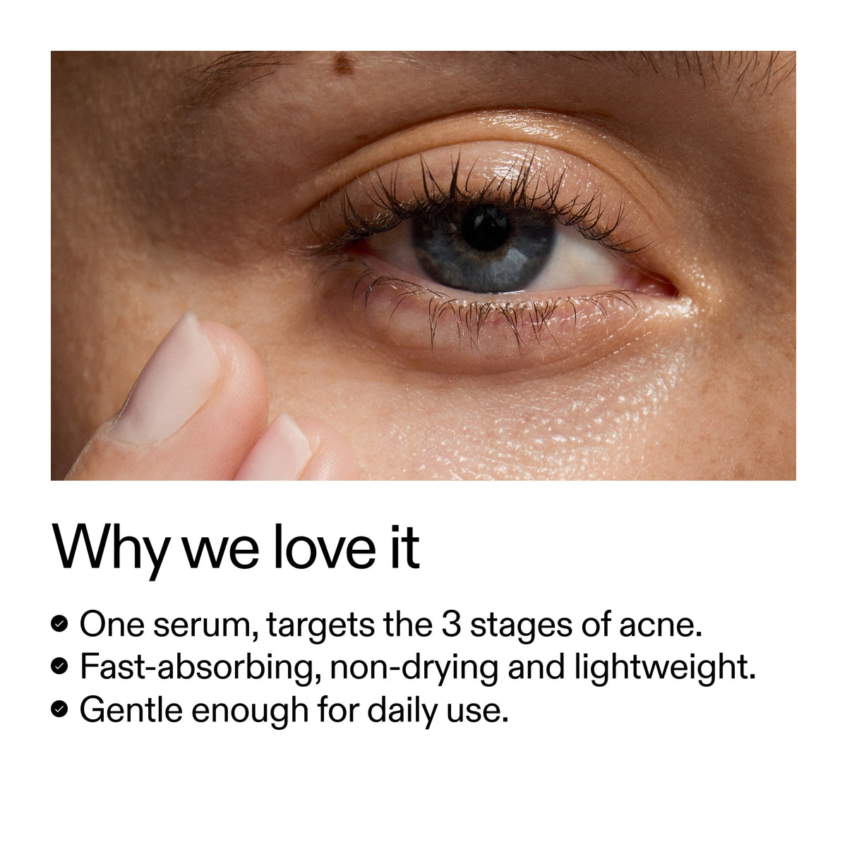360-acne-clearing-duo-o1 Dioic_Whyweloveit_2000x2000_175aafd3-0cbe-403a-b317-a8362881bfe2.jpg