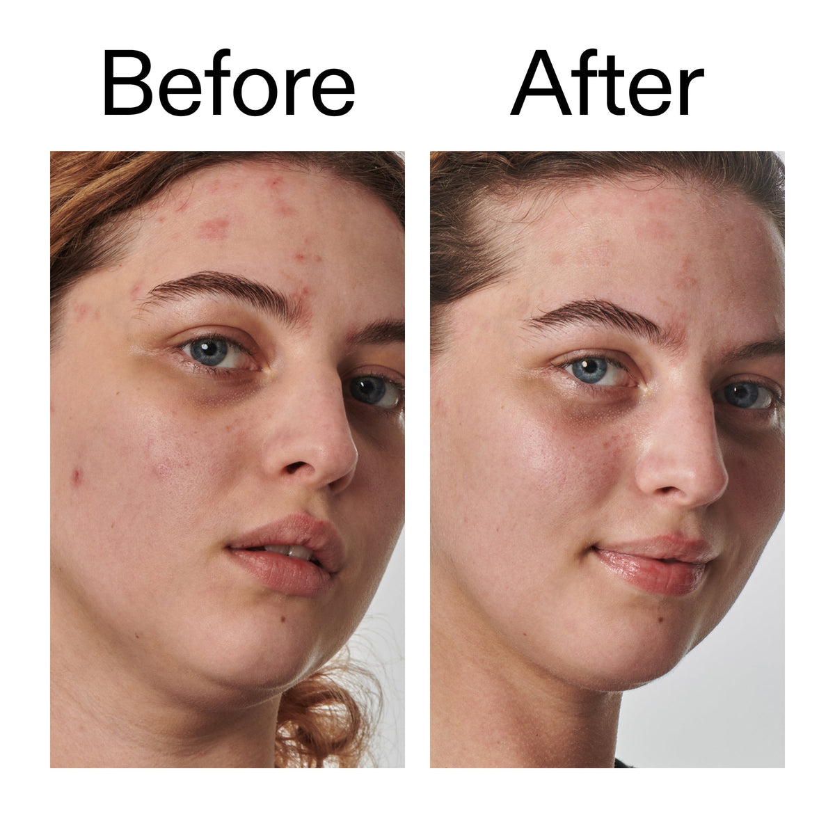 10-urea-moisturizer-s1 Dry_and_Rough_Skin_Solution_Before_After_2000x2000_efa6e639-5c39-49bd-a5dd-f0220293120a.jpg