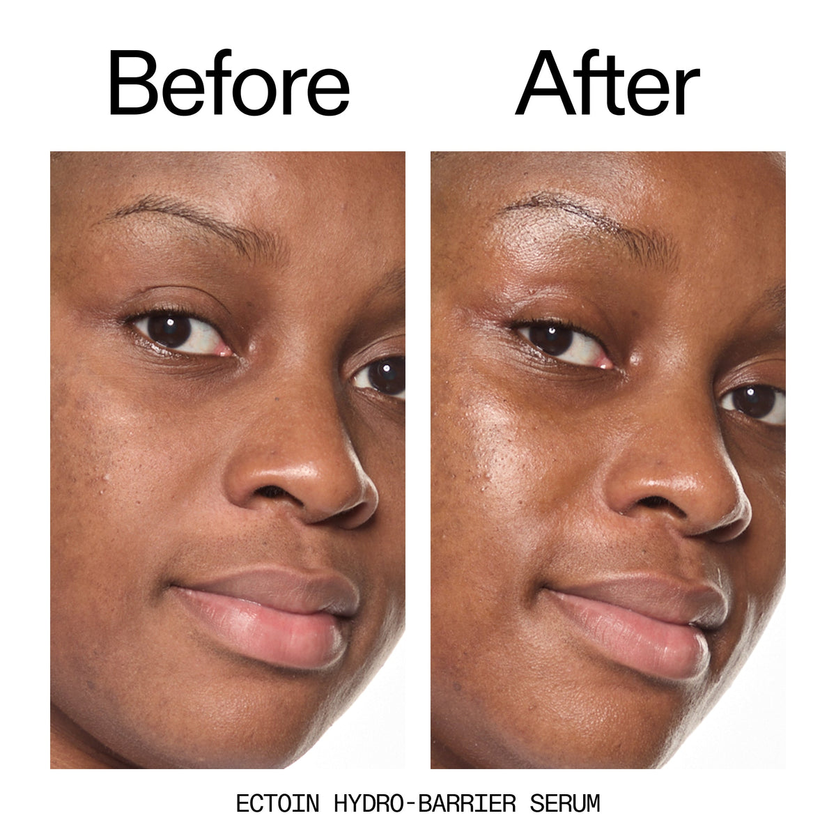 barrier-boosting-trio-g2 Ectoin_Before_After_2000x2000_ce35bc41-4da0-4b6f-adc7-29f8641f6c6c.jpg