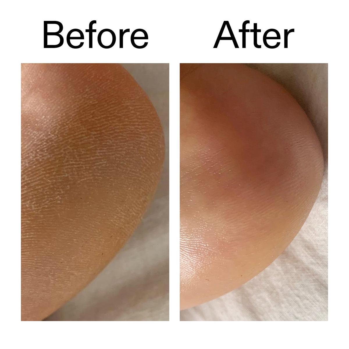 glycolic-acid-exfoliating-body-stick-r7 Glycolic_Acid_Exfoliating_Body_Stick_Before_After_V1_2000x2000_a3043625-9400-429a-a7fb-d6dbd220f722.jpg