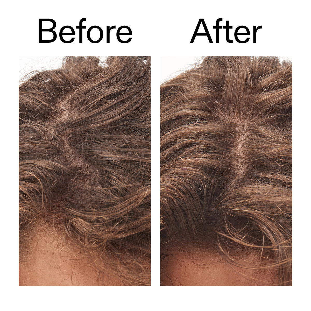 glycolic-acid-exfoliating-scalp-scrub-g0 Glycolic_Acid_Exfoliating_Scalp_Scrub_Before_After_2000x2000_b8561c87-05a1-4caa-80f7-1b6b33d750f7.jpg