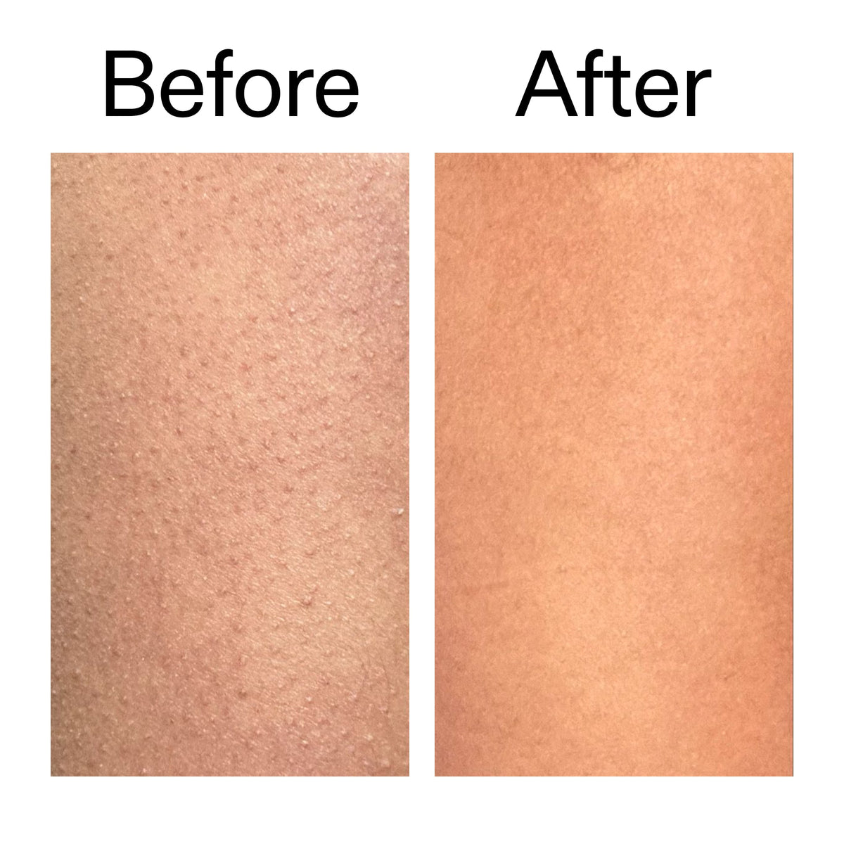 glycolic-acid-exfoliating-body-stick-r7 Glycolic_Body_Stick_B_A_2000x2000_6e6e6b4d-5bd7-43c0-aeed-4d66788e8995.jpg