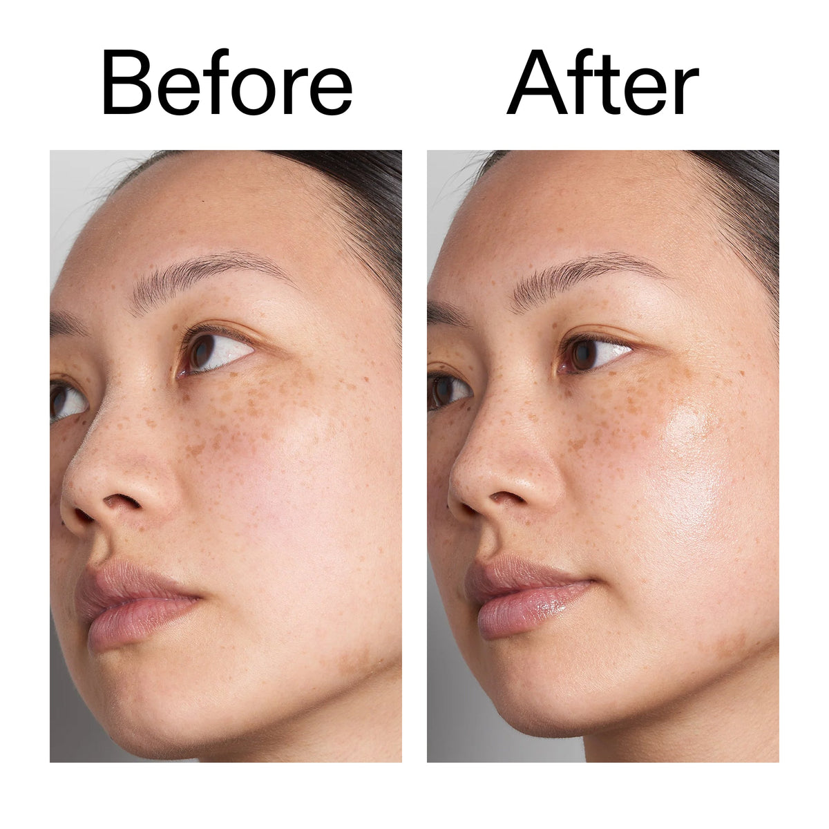 hyaluronic-acid-serum-30ml-m6 Hyaluronic_Acid_Before_After_2000x2000_d7983956-8aa2-4ea3-8255-c63e8d4f892e.jpg