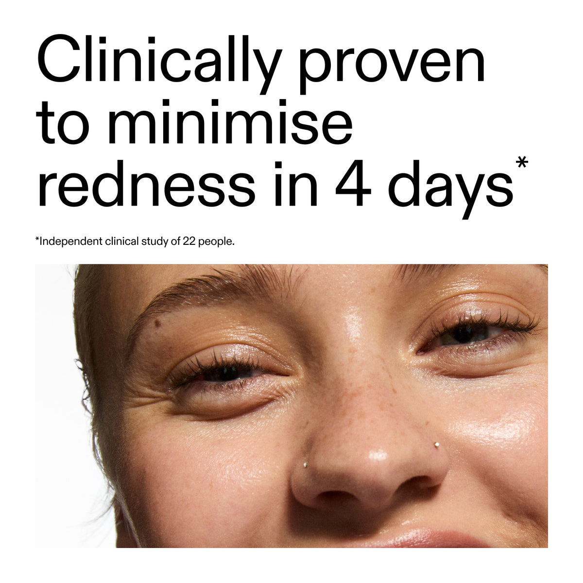 10-azelaic-acid-serum-for-redness-relief-f3 Oat_Cleansing_Balm_Claim_2000x2000_52a841dc-353c-4f2c-8646-3aadb604507d.jpg