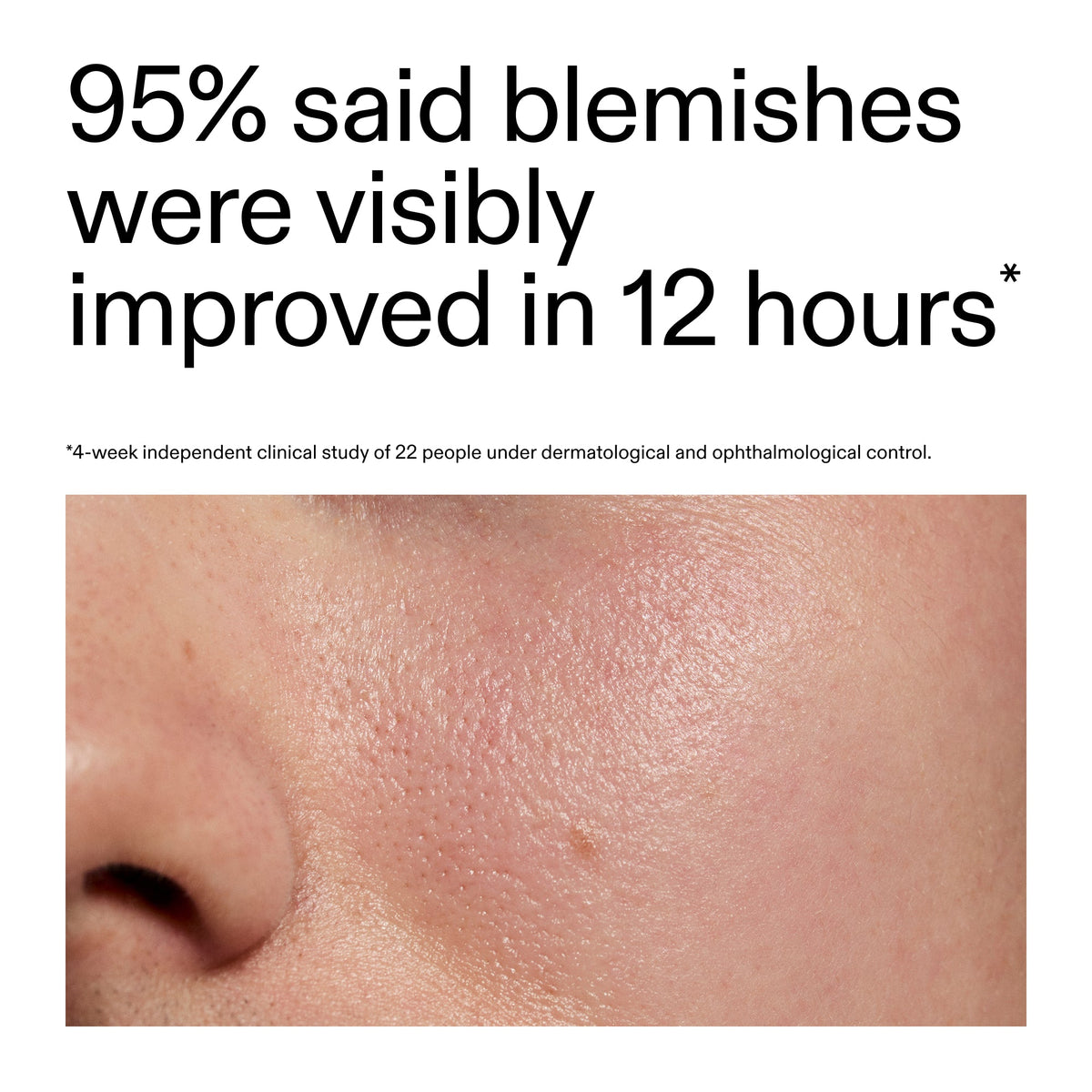 succinic-acid-acne-treatment-m8 Oat_Cleansing_Balm_Claim_2000x2000_ac6ce553-25db-41b2-a981-faae1ac4b8c0.jpg