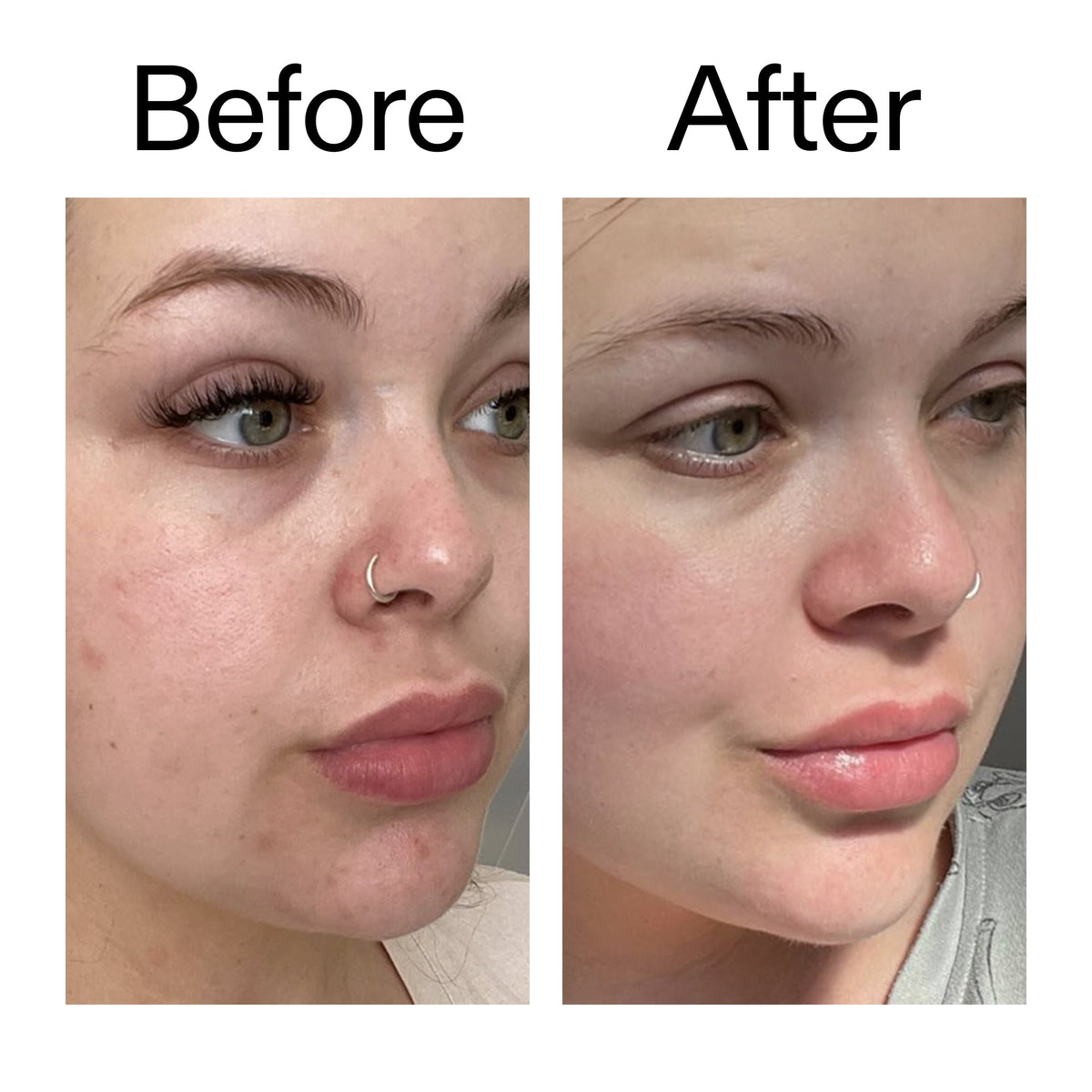 supersize-omega-water-cream-duo-o8 Omega50_Before_After_2000x2000_46483ed8-3f9d-487f-9a0c-9df79830bd65.jpg