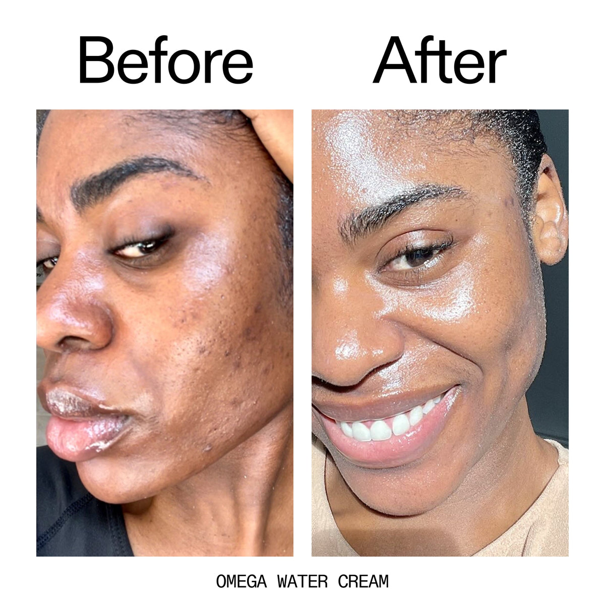 glowing-skin-set-i3 Omega_Water_Cream_Before_After_2000x2000_8e88278b-8c8d-48dc-ac77-4e98ebbd1b77.jpg