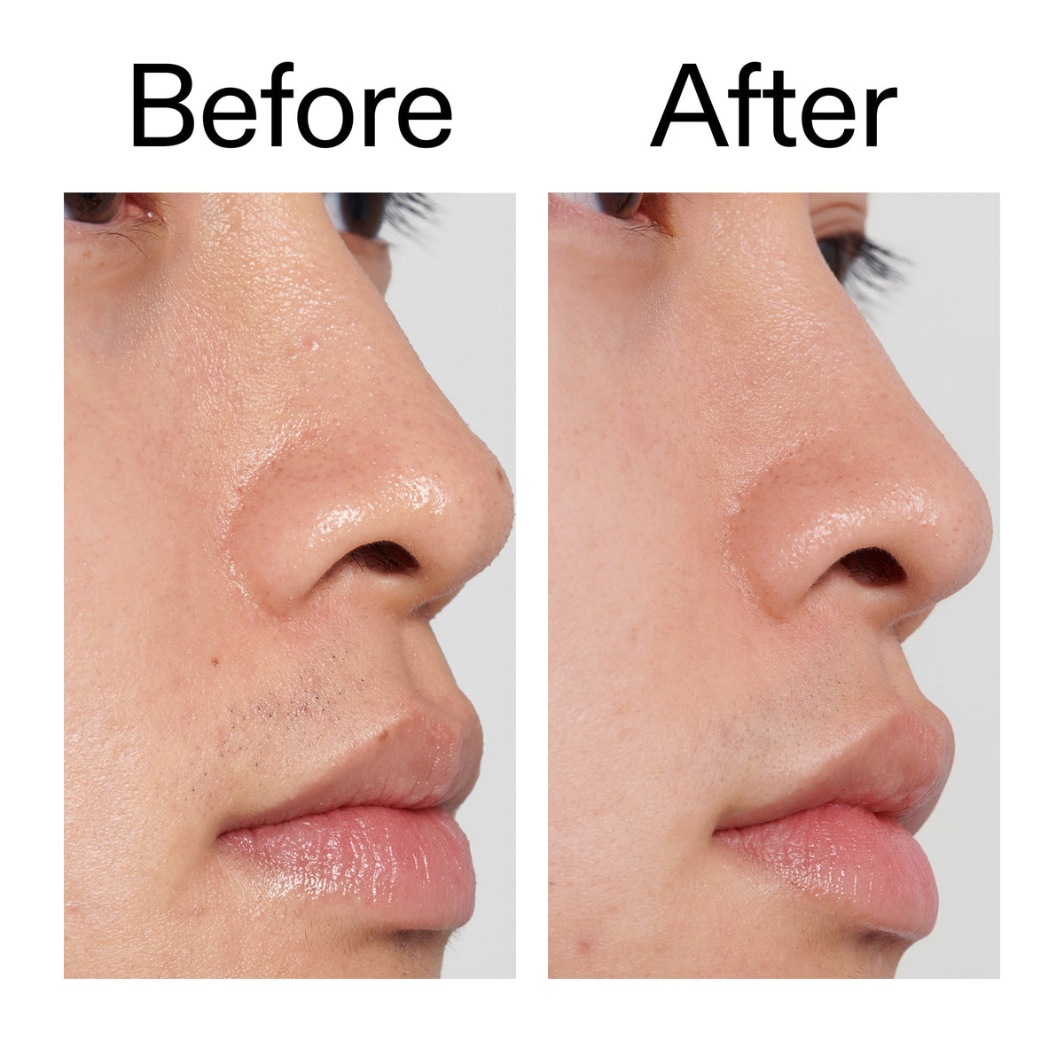 pha-toner-u1 PHA_Toner_Before_After_2000x2000_e3c10172-0150-4342-8b95-57417eaff50d.jpg