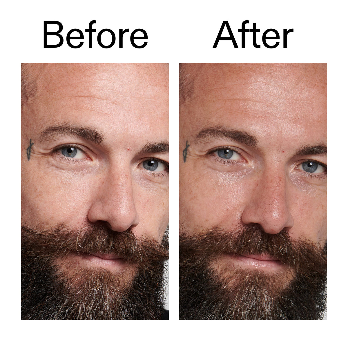 peptide-moisturizer-l1 Peptide_Moisturizer_Before_After_2000x2000_84623fe4-7b72-4f89-8e87-5edb6c752ac5.jpg
