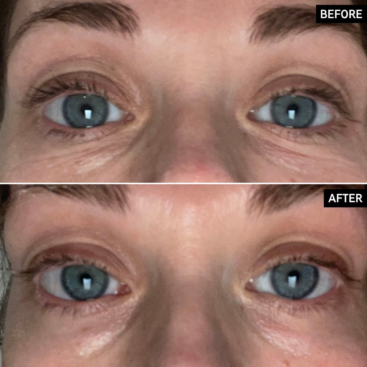 retinol-eye-cream-l9 SITE-UGCBAsApril_Nicole_B_A_PPage_2000x2000_1.jpg