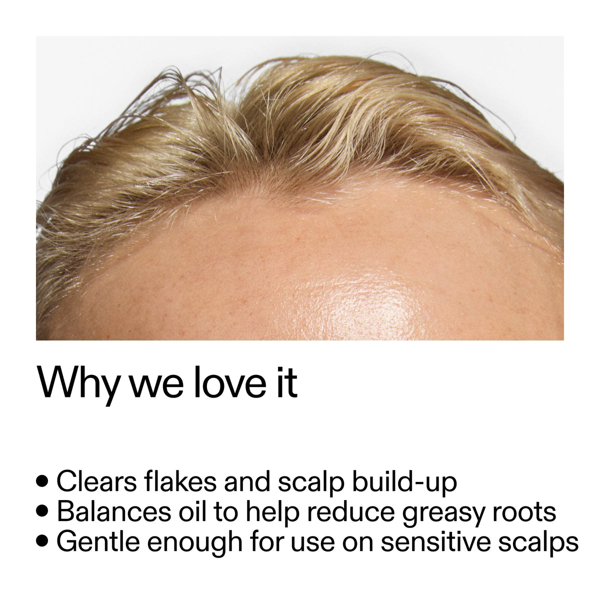 salicylic-acid-exfoliating-scalp-treatment-f1 Salicylic_Acid_Exfoliating_Scalp_Treatment_Why_we_love_it_2000x2000_44b6bd6d-9ec4-4b23-9dc4-bc3fd6f28e14.jpg