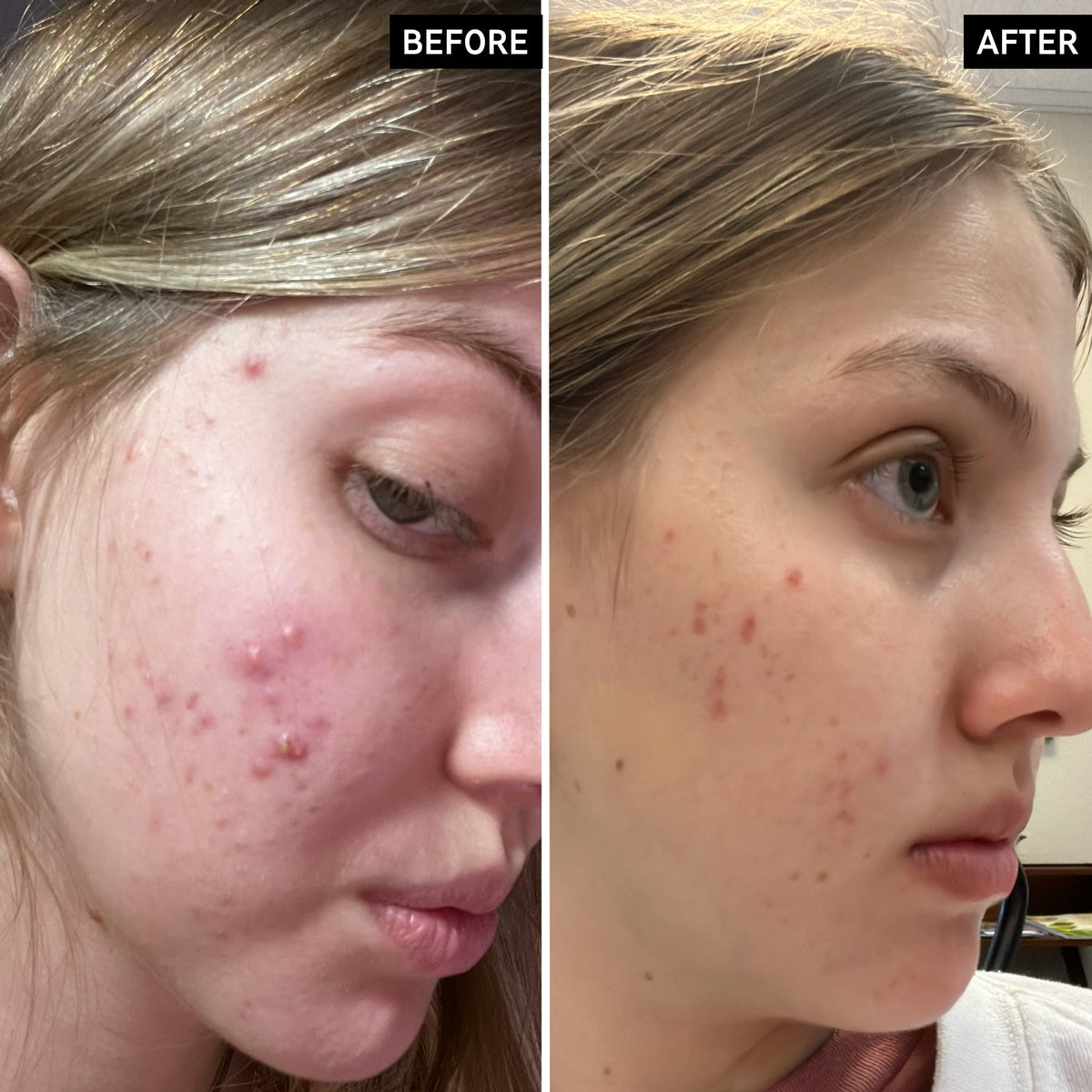 salicylic-acid-cleanser-150ml-f0 SamanthaB_A_2000x2000_54062586-cec1-44d9-a20a-bda2c4f03f5f.jpg