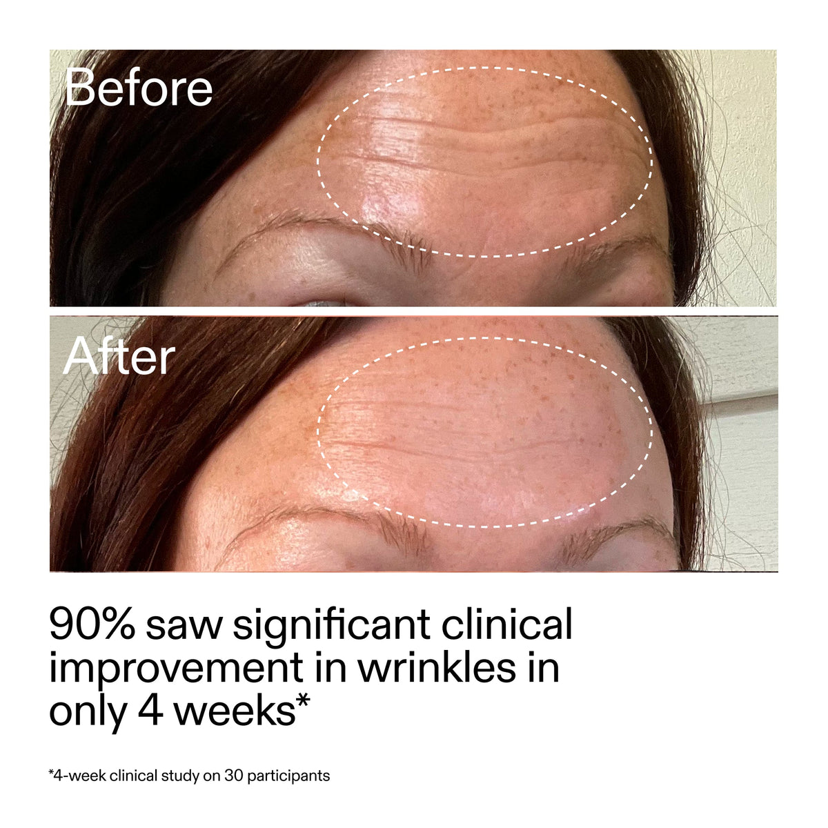 starter-retinol-serum-a1 StarterRetinol_BeforeAfter_Claim1_2000x2000_a09b50b6-4688-4527-abae-21bd142b89b7.jpg