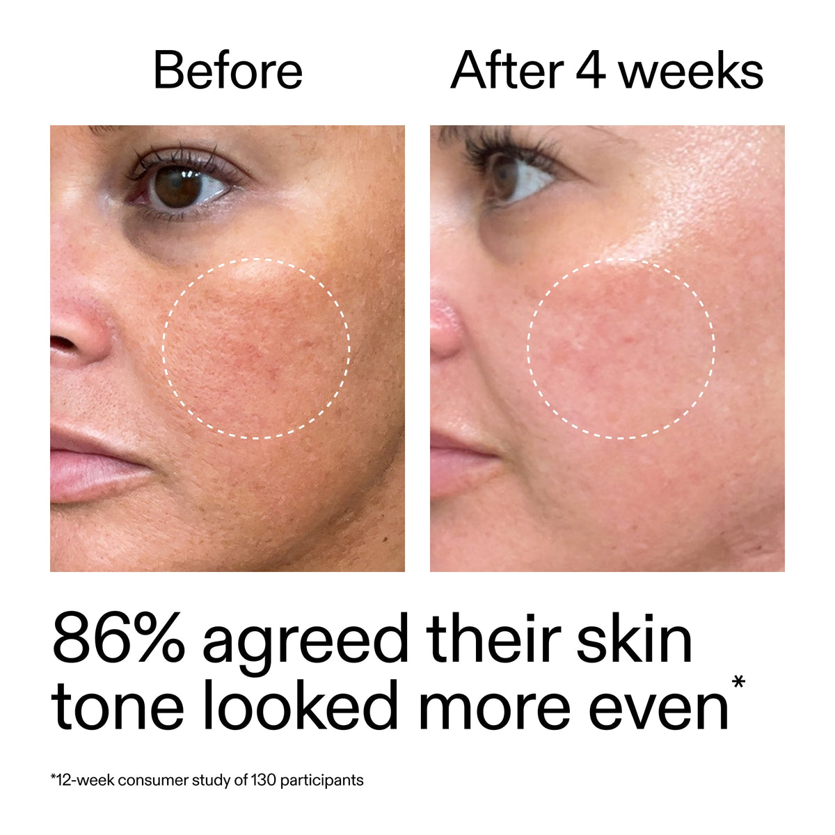 starter-retinol-serum-a1 StarterRetinol_BeforeAfter_Claim2_2000x2000_f5c9ecc0-8d76-429d-bef5-c3a61bcf5c09.jpg