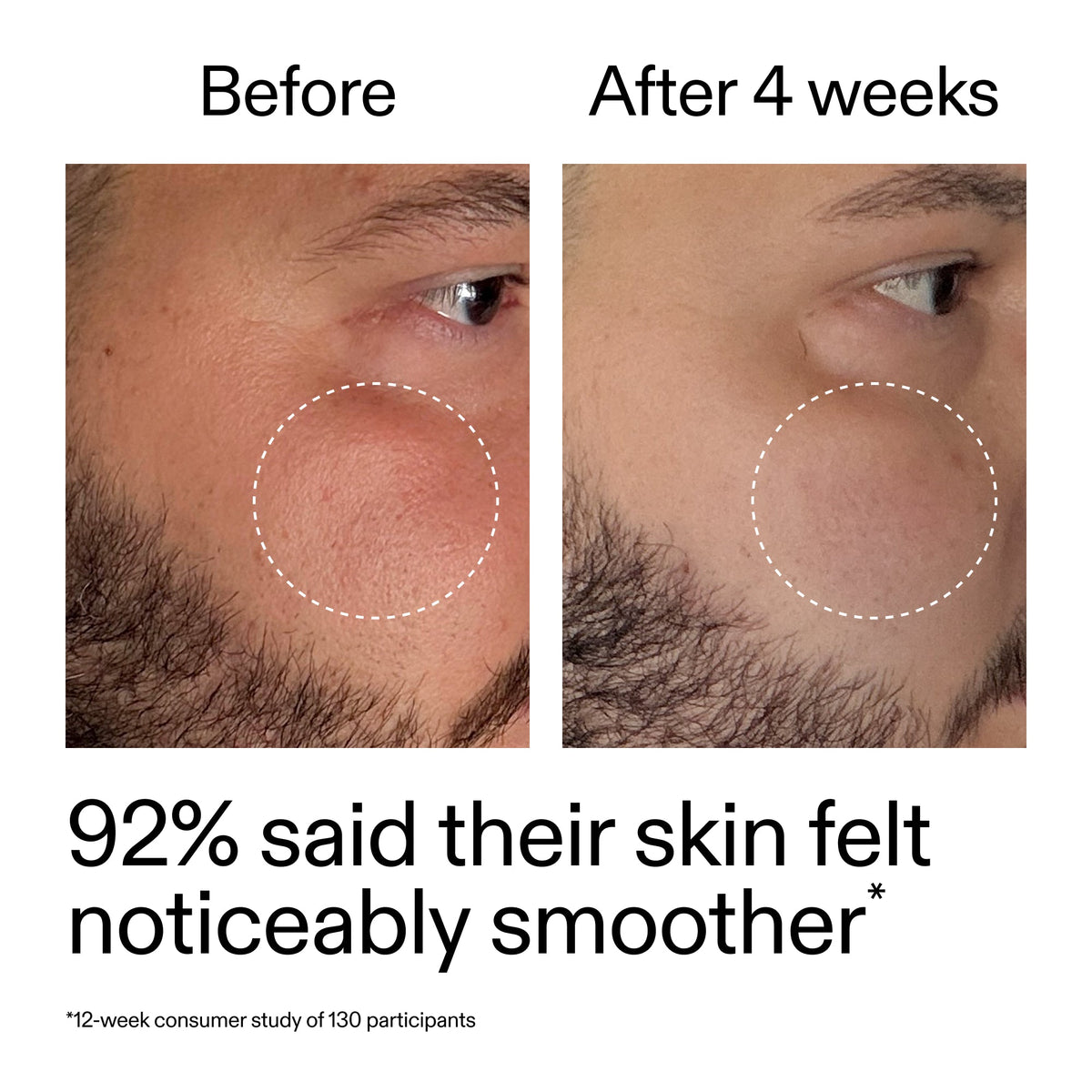 starter-retinol-serum-a1 StarterRetinol_BeforeAfter_Claim3_2000x2000_6ceab106-e0ee-4ed4-ba62-41bc39538038.jpg