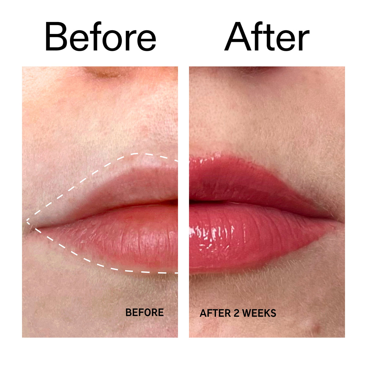 tripeptide-plumping-berry-lip-balm-y7 Tripeptide_Plumping_Lip_Balm_-_Berry_Before_After_2000x2000_9474bbd8-43ca-4b0e-b0e7-dfab70b91927.jpg