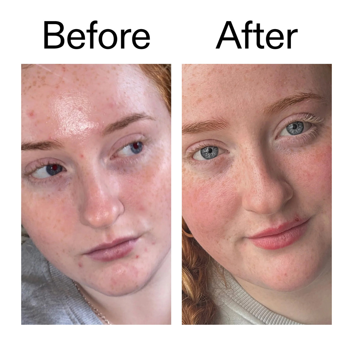 vitamin-b-c-and-e-moisturizer-c4 Vitamin_B_C_and_E_Moisturizer_Before_After_2000x2000_b0781a76-5ad2-4be9-95b8-ef92b356833c.jpg